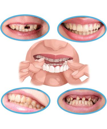 Temporary Fake Dentures Teeth for Broken, Gap & Missing Teeth - Improve Smile - Buy Online on GoSupps.com