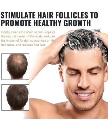 Root-activating shampoo thickening shampoo for hair loss promotes regrowth formula - Buy Online on GoSupps.com