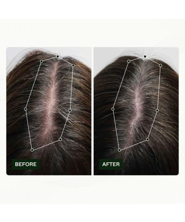 Scandinavian Biolabs Hair Strength Shampoo & Bio-Pilixin Serum for Women | Strengthen & Moisturize Hair with Gentle Clean Formula - International Shipping Available - Buy Online on GoSupps.com