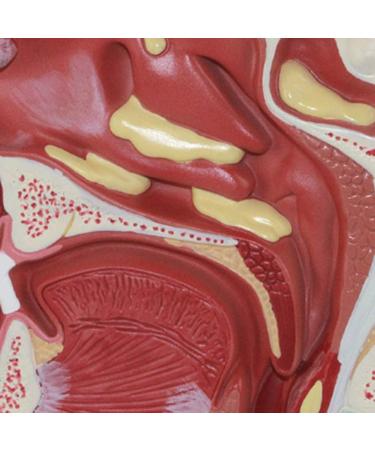 Nasal Cavity Oral Cavity Throat Lesion Model Rhinitis Polyp Tonsillitis-with Base-Medical Research-23 x 11 x 11Cm - Buy Online on GoSupps.com