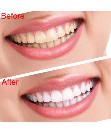 Teeth Whitening Accelerator Cold 6LED Light Lamp - Professional Teeth Whitening Machine - Buy Online on GoSupps.com