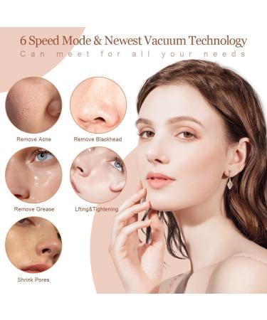 Blackhead Remover Black Head Remover for Face Whitehead Acne Remover with 6 Suction Power 4 Probes and LED Display Deep Cleansing Unclogging Pores Blackhead Remover Tool - Buy Online on GoSupps.com