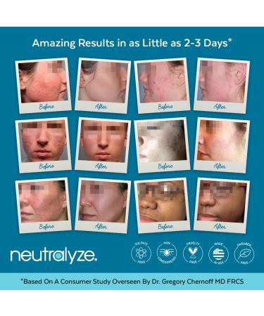 Neutralyze Renewal Complex Acne Moisturizer for Face - 2% Mandelic & Salicylic Acid Cream - Acne Prone Skin - 90+ Day Supply - Buy Online on GoSupps.com