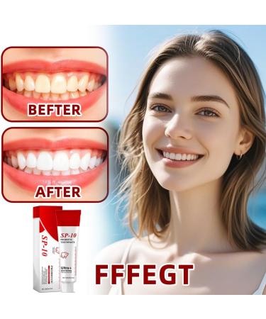 Teegxddy 2 stuks Sp10 Probiotic Toothpaste 120G Probiotic Toothpaste Sp10 Whitening Toothpaste for Deep Cleaning Toothpaste SP10 Ultra Whitening Fresh Breath - Buy Online on GoSupps.com