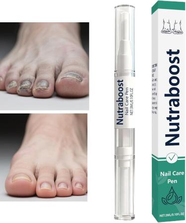 Natural Nail Care Pen Reduces Yellowing 3ml Toenail Repair Solution Nail Strengthening Treatment Fast Absorption For Thickening Skin Women Men Elderly Feet Home Mani - Buy Online on GoSupps.com