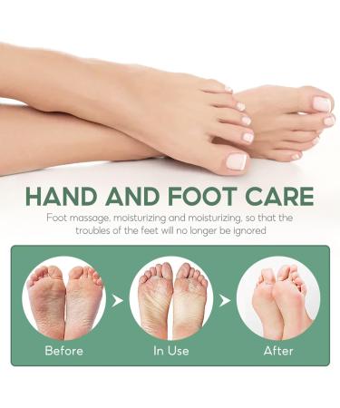 Urea 40% Foot Cream - Cracked Heel Repair Cream - Foot Cream for Cracked Heels and Dry Skin - Urea Cream for Feet with Tea Tree Oil Aloe Vera and Chamomile for Deep Moisturizing - Buy Online on GoSupps.com