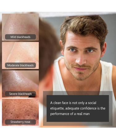 Nosestripes Blackhead Clearing Strips - 25 Pieces for Men & Women | Pore Strip Solution for Clear Skin - Buy Online on GoSupps.com