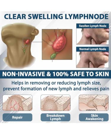 ATTDX Black Cumin Herbal Cream Effectively reduce leg discomfort (3) - Buy Online on GoSupps.com