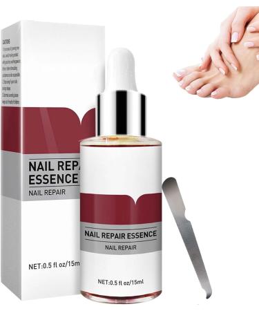 Fungal Nail Treatment For Toenails Nail Repair Essence Extra Strong Extra Strong Nail Fungus Treatment for Toenail Fingernail & Toenail Care Solution 2024 New (1 Bottle)
