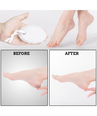 Pumice Stone Set for Feet: Exfoliating and Polishing Scrubber - Buy Online on GoSupps.com