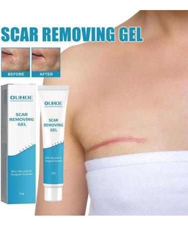 WWDZ Scar Removal Cream Gel - 2pcs Set for Repairing Pock Marks, Burns, Surgical Scars, and Cesarean Scars - Stretch Mark Treatment and Skin Moisturizer - Buy Online on GoSupps.com