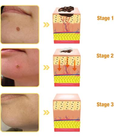 AAFQ Professional Bee Venom Treatment Cream 2024 Professional New Bee Venom Repair Cream Hydrating Moisturizing Treatment for Men&Women 1Fl Oz (1) - Buy Online on GoSupps.com