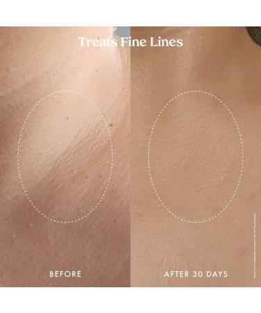 Kopari Ultra Renewal Retinol Body Cream Infused with Acai & Encapsulated Retinol Treat Fine Lines & Crepey Skin Resurface & Boosts Collagen 4.7 oz - Buy Online on GoSupps.com