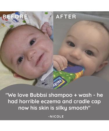 Bubbsi Coconut Oil Baby Shampoo & Wash | Gentle, Organic, Sulfate-free Formula | Cradle Cap & Eczema Relief | Refillable 8oz Bottle - Buy Online on GoSupps.com