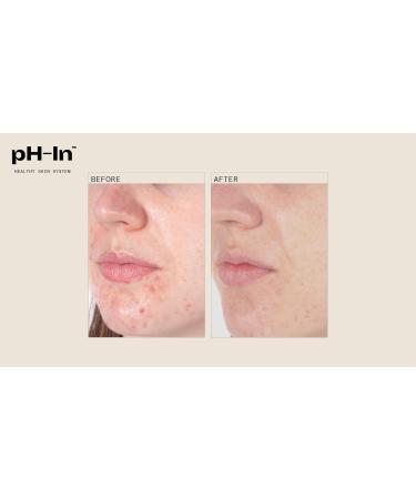 3 Step Healthy Skin System | Achieve Radiant Skin | International Shipping Available - Buy Online on GoSupps.com