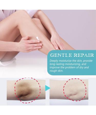 MINGRUO Dark Spot Removal Cream Dark Spot Correction Acanthosis Nigricans Therapy Cream for Dark Skin - Buy Online on GoSupps.com