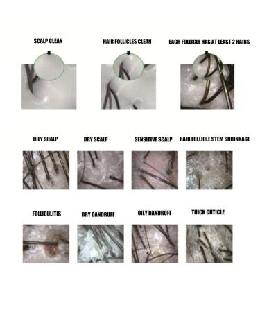 100x Skin & Hair Detector | WiFi Follicle Analyzer for Scalp Health | 0.3 MP Hair Diagnosis Tool - Shop Internationally! - Buy Online on GoSupps.com