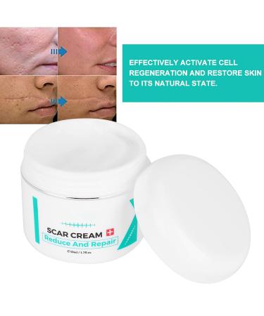 Scar Removal Cream - Pregnancy, Acne, Facial & Skin Repair Treatment Gel - Buy Online on GoSupps.com