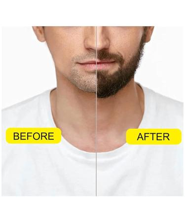 Ultimate Beard Care Set: Bart Flushing Beard Oil Shampoo Mustache Styling Comb Foam Cream & Wax - Perfect Gift for Men Dads & Friends - Buy Online on GoSupps.com