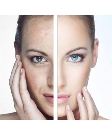 S Rum Hydratant Anti-Rides Et Anti- Ge Ingr Dients Naturels Hypoallerg Niques Apaisant 30ml (1) 6 ml (Lot de 5) - Buy Online on GoSupps.com