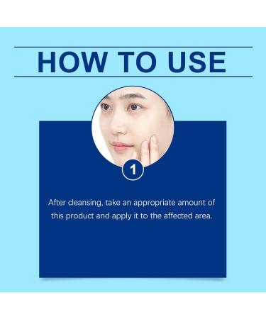  Generisch Acne Treatment Gel 0.1% 15g acne skin care gel with Defenses Plus Contains Lemon Eucalyptus and Hyaluronic Soothing Skin Protection (2) - Buy Online on GoSupps.com