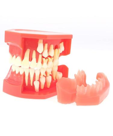 Lmeil tooth deformality-toothing-to-toothing development model milk teeth-constant pressure change model silicone material suitable for the tooth lessons of children