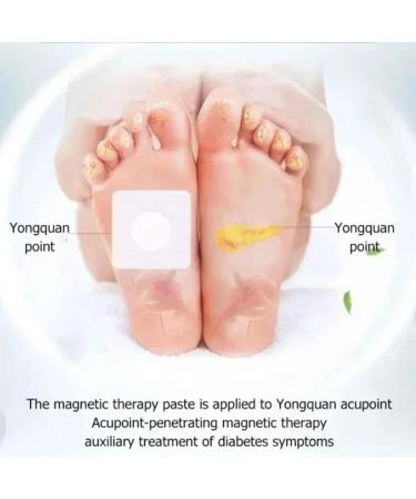 Higyee Tang Xiao Paste Acupuncture Sticker - Effective Foot Pavement for Sugar Control | Easy Relaxing Pressure Stimulation for Women - International Shipping Available - Buy Online on GoSupps.com