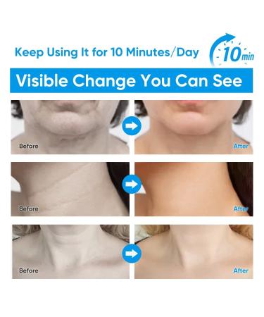 Red Light Therapy Face Massager for Neck Lines, Wrinkles & Double Chin Reduction - Buy Online on GoSupps.com