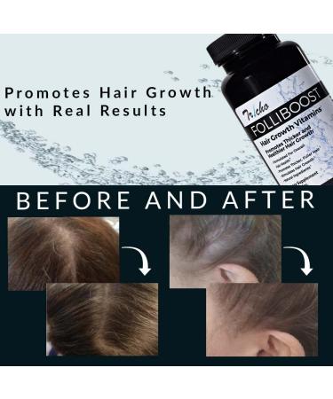 Folliboost Tricho Hair Growth Vitamins with Biotin, Vitamin C, Zinc, Vitamin B12 - Promotes Thick, Full Hair Growth - Natural-Based Hair Care Formula - Made in USA (30-Day Supply) - Buy Online on GoSupps.com