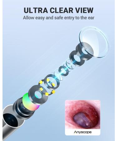 AnyScope HD Digital Otoscope Video Ear Scope Otoscope with Light Ultra Clear View Ear Camera with Ear Wax Removal Tools Compatible with iPhone and Android Devices (Silver)  - Buy Online on GoSupps.com