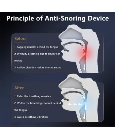 Smart Adjustable Electric Nasal Dilators - Anti Snoring Sleep Aid with Double Eddy Current Fan - Improved Nighttime Sleeping Solution - Buy Online on GoSupps.com