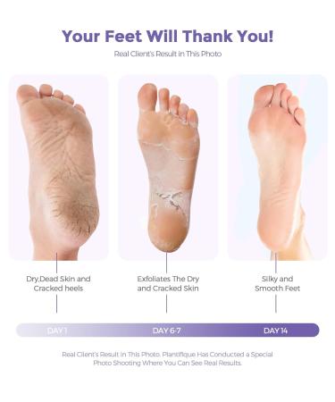 Buy Lavender Foot Peel Mask - Natural Exfoliator for Dry Skin Calluses & Cracked Heels - Baby Soft Feet Repair - Buy Online on GoSupps.com