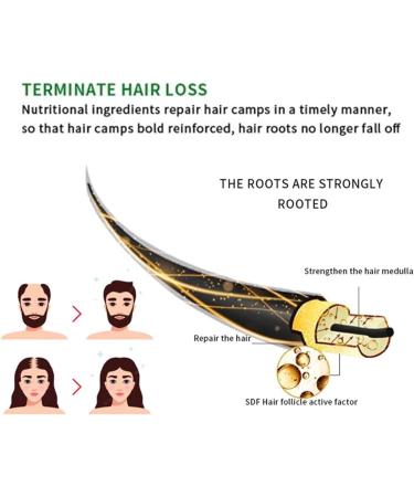 Eayoly Hair Growth Serum - 120ml Hair Lotion Hair Growth Serum Nourishing Nutrient Hair Lotion for Strong And Dense Hair Anti Hair Loss Promotes Hair Root - Buy Online on GoSupps.com