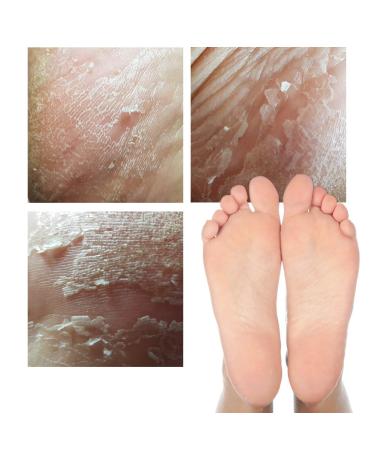 Elizavecca Witch Piggy Hell-Pore Turtle Foot Pack - Exfoliating & Moisturizing (1 Pair, 1.41 oz) - Buy Online on GoSupps.com