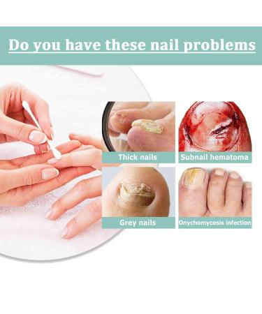 Nail Care Pen for Nail Fungus Treatment | Nourish Fingernails & Toenails with Aloe Vera Tea Tree Oil & Vitamin E | 3 Pieces - Austria - Buy Online on GoSupps.com