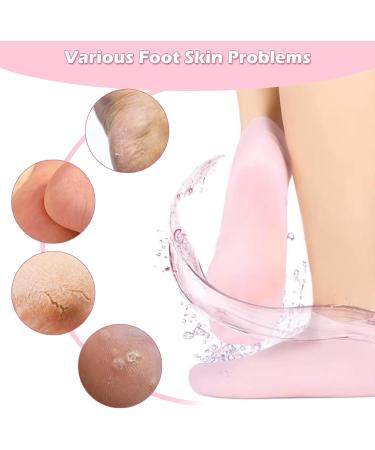 Ninnyi 2 Pairs Moisturizing Silicone Glove Socks Women Set Foot Spa Gel Pedicure Silicone Socks for Dry Cracked Feet Calluses Foot Care Pink Anti Slip Aloe Socks - Buy Online on GoSupps.com