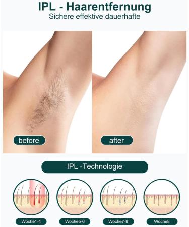 IPL Hair Removal Devices for Men & Women | Painless Laser Hair Removal with Cooling Function for All Body Areas - Buy Online on GoSupps.com