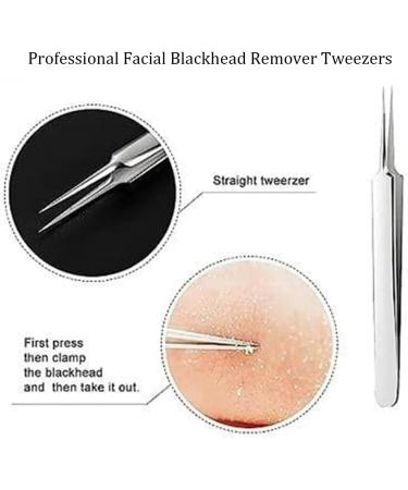 Usiveinborn Blackhead Remover Usiveinborn Tweezers Usiveinborn Professional Stainless Steel Facial Blackhead Remover Tweezers (Set* B) - Buy Online on GoSupps.com