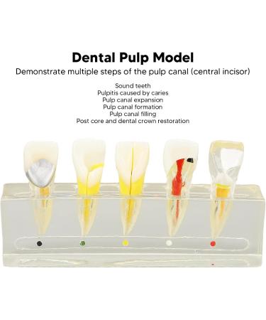 Professional Removable Zahnpulpa Model - Dental Endodontic Training Tool | Stable Resin for Students - Buy Online on GoSupps.com