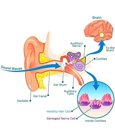 Endxedio Japanese Ear Ringing Treatment Oil 10ml - Organic Ear Wax Removal Drops (3pcs) - Buy Online on GoSupps.com