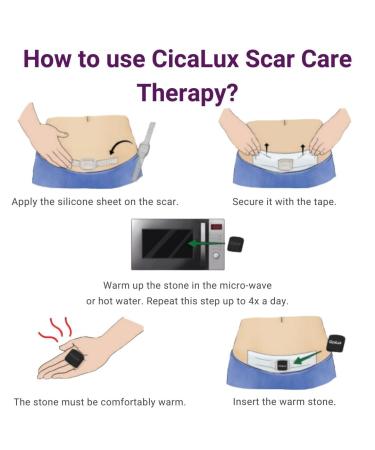 CicaLux Silicone Scar Tape - Triple Action Treatment for Surgical Scars - 60 Day Supply - Buy Online on GoSupps.com