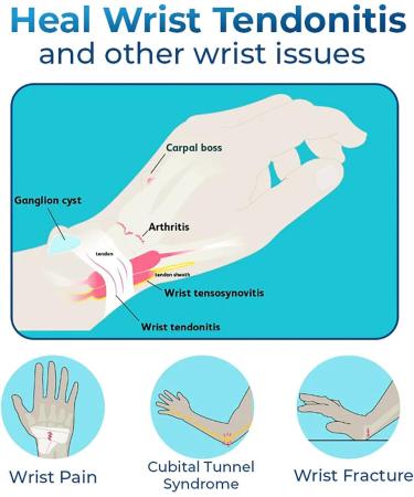 German Wrist Tendonitis Therapy Oil German Anti Paronychia Relief Oil Holistics Muscle Relief Massage Oil Massaging Joint & Muscles (3 pcs) - Buy Online on GoSupps.com