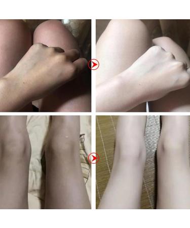 Body Lotion Beauty Benefits of Body Lotion 24 Hour Intense Hydration Gentle Moisturizing Firming Lotion for Body Face Underarms Knees and Elbows - Buy Online on GoSupps.com