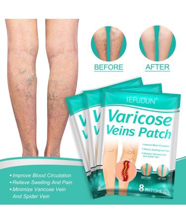Spier 8 Pcs Varicose Veins Patch - Effective Spider Veins Removal Plaster for Leg Care | Fast International Shipping - Buy Online on GoSupps.com