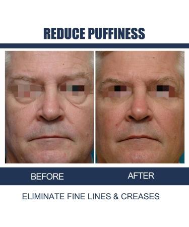 TATOS Anti-Aging Eye Cream for Men Fade Eye Fine Lines Repair Eye Bags Dark Circles - Buy Online on GoSupps.com