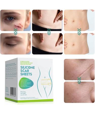 Medical Grade Silicone Scar Tape for Surgery Recovery - Neck, Nose, C-sections, Acne & Wounds - Buy Online on GoSupps.com