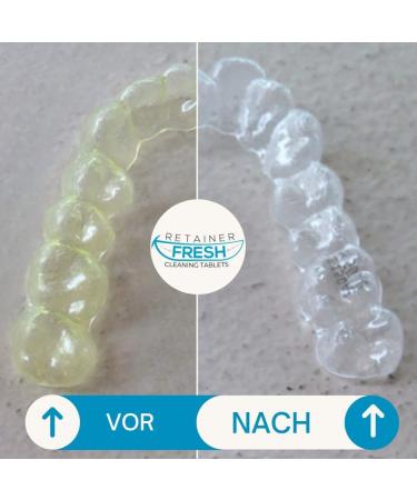 Retainer Cleaning Tablets - 120 Count for 4 Months Supply - Stain-Free & Fresh Brite - Cleaner for Retainer, Mouth Guard, Dentures, Aligners - Buy Online on GoSupps.com