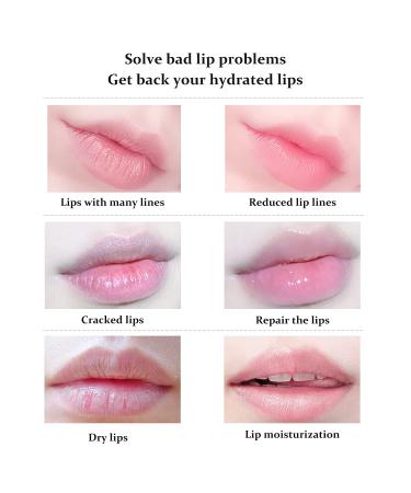 FREEORR 20Pcs Moisturizing Lip Mask - Nourishes & Restores Dry Lips | Lip Care for FallWinter (Pink) - Buy Online on GoSupps.com