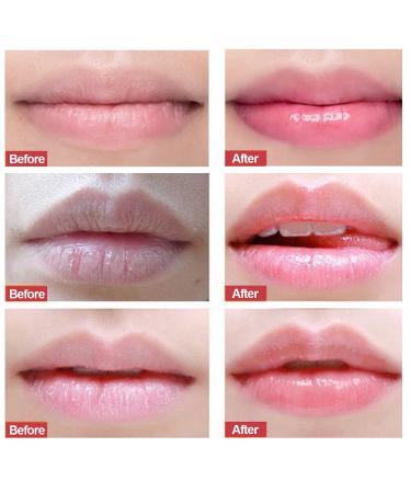 Strawberry Lip Peeling & Scrub - Hydrating Treatment for Cracked Lips Lip Mask for Repairing Cuticles & Fading Lines | International Shipping - Buy Online on GoSupps.com