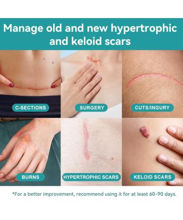 Dimora Waterproof Silicone Scar Sheets - Medical Grade Scar Tape for Surgical Scars C-Section & Keloids | Ultra-Thin Scar Removal Treatment (1.6 x120 Roll - Buy Online on GoSupps.com